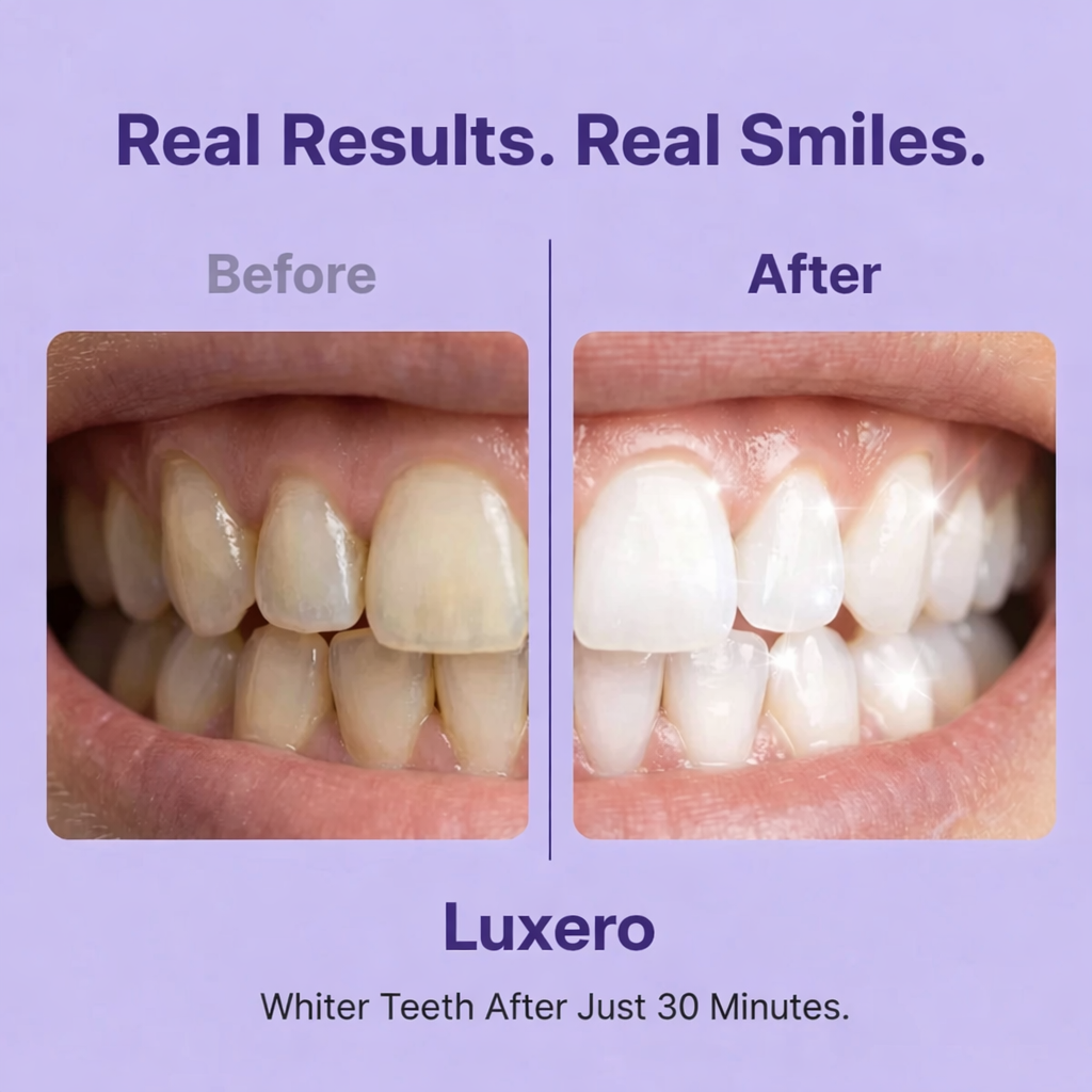 Luxero Purple Teeth Whitening Strips
